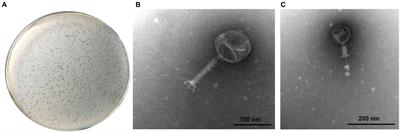 Application of a novel lytic phage vB_EcoM_SQ17 for the biocontrol of Enterohemorrhagic Escherichia coli O157:H7 and Enterotoxigenic E. coli in food matrices